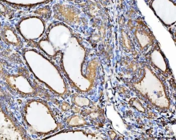 CHM Antibody / Choroideremia protein - image 1