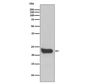 Interferon beta Recombinant Antibody / IFNB1 - image 1