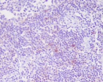 CD25 Recombinant Antibody / IL2RA - image 1