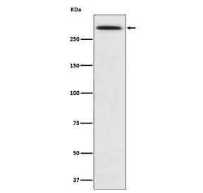 SPTA1 Recombinant Antibody / Spectrin alpha 1 - image 1