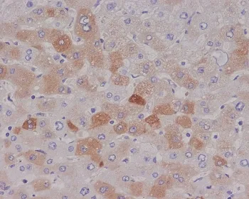 C Reactive Protein Recombinant Antibody / CRP - image 1