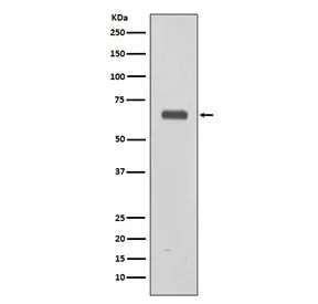C9 Recombinant Antibody / Complement component C9 - image 1