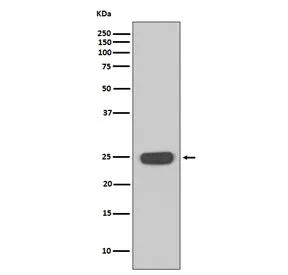 Interferon gamma Recombinant Antibody / IFNG - image 1