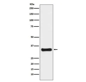 Thymidylate Synthase Recombinant Antibody - image 1