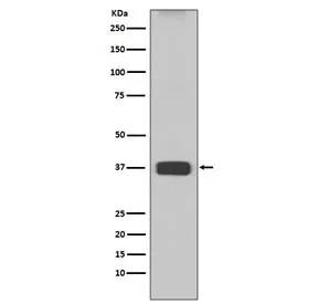Arginase 1 Recombinant Antibody - image 1