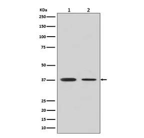 Arginase 1 Recombinant Antibody - image 1