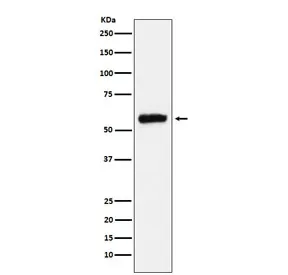 ALDH2 Recombinant Antibody - image 1