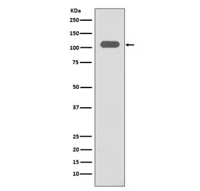 Integrin beta 3 Recombinant Antibody / ITGB3 / CD61 - image 1