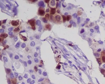 S100A8 Recombinant Antibody / MRP8 / Calgranulin A / Calprotectin L1L - image 1