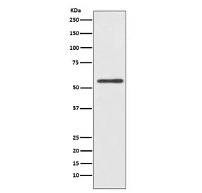 CYP2E1 Recombinant Antibody - image 1