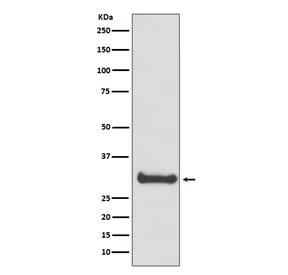 Calbindin Recombinant Antibody / CALB1 - image 1