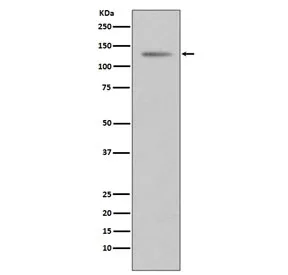 Progesterone Receptor Recombinant Antibody - image 1