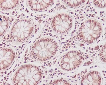 CDK1 Recombinant Antibody - image 1