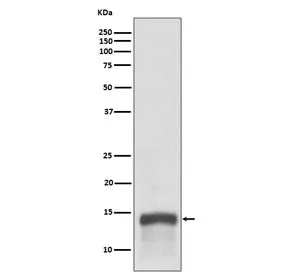 S100A9 Recombinant Antibody / MRP14 / Calgranulin B / Calprotectin L1H - image 1