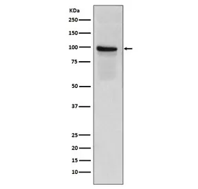 Thrombomodulin Recombinant Antibody / CD141 - image 1