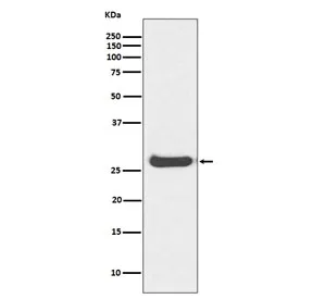Histone H1.0 Recombinant Antibody / H1F0 - image 1