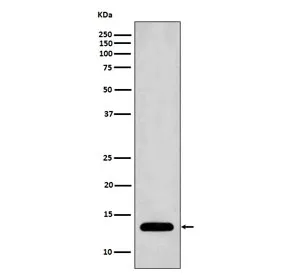 Profilin 1 Recombinant Antibody - image 1
