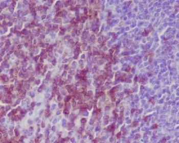 CD3 epsilon Recombinant Antibody - image 1