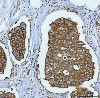 HSP90 alpha/beta Recombinant Antibody - image 1