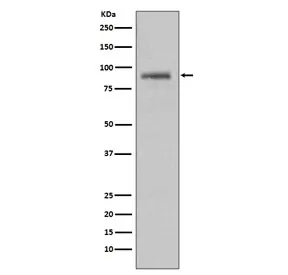 HSP90 alpha Recombinant Antibody / HSP90AA1 - image 1