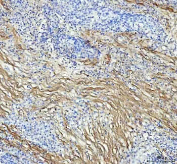 Collagen I Recombinant Antibody / COL1A1 - image 1