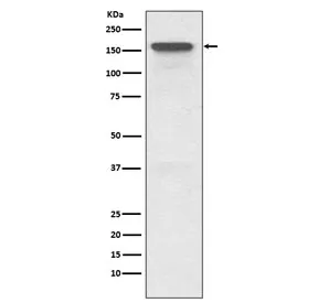 P Glycoprotein Recombinant Antibody / MDR1 / ABCB1 - image 1