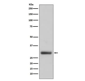 Neutrophil Elastase Recombinant Antibody - image 1