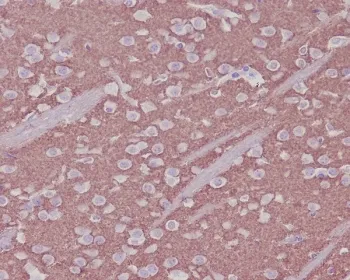 Synaptophysin Recombinant Antibody - image 1