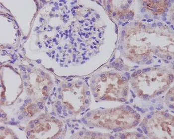 Synaptophysin Recombinant Antibody - image 1