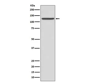 CD41 Recombinant Antibody / ITGA2B - image 1