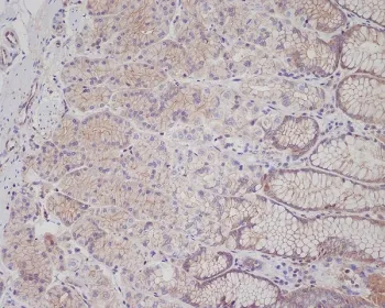 MET Recombinant Antibody / c-Met / HGFR - image 1