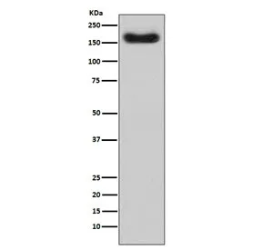CFH Recombinant Antibody / Complement factor H - image 1