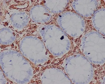 Vimentin Recombinant Antibody - image 1