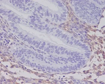 Platelet Derived Growth Factor Receptor beta Recombinant Antibody / PDGFRB - image 1