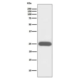 CSF3 Recombinant Antibody / Granulocyte-Colony Stimulating Factor - image 1