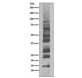 Ubiquitin Recombinant Antibody / K63-Linkage Specific - image 1