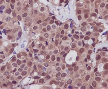 HSP70 Recombinant Antibody / HSPA1A / HSPA1B - image 1