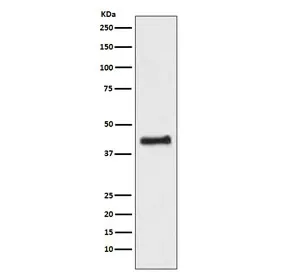 COUP TF1 Recombinant Antibody / NR2F1 - image 1