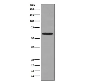HSP60 Recombinant Antibody - image 1