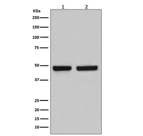 HAPLN1 Recombinant Antibody - image 1