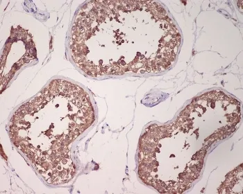 GRP78 Recombinant Antibody / BiP / HSPA5 - image 1
