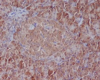 GRP78 Recombinant Antibody / BiP / HSPA5 - image 1