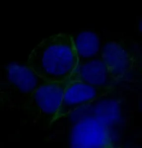 GLUT1 Recombinant Antibody / SLC2A1 - image 1
