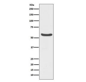 GLUT2 Recombinant Antibody / SLC2A2 - image 1
