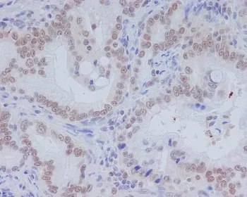 CD11b Recombinant Antibody / MAC-1 - image 1