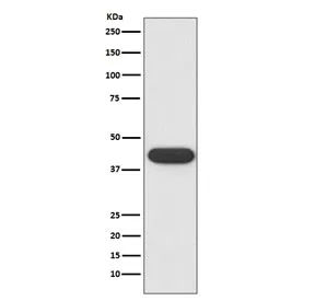 CD32 Recombinant Antibody / FCGR2A - image 1