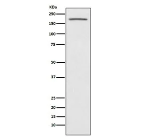 ACE Recombinant Antibody / Angiotensin-Converting Enzyme - image 1