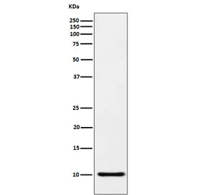 CCL5 Recombinant Antibody / RANTES - image 1