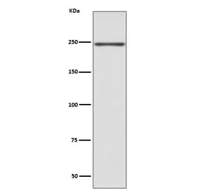 MYH6 Recombinant Antibody / Myosin 6 - image 1