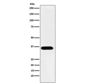 TRAcP Recombinant Antibody / TRAP / ACP5 - image 1